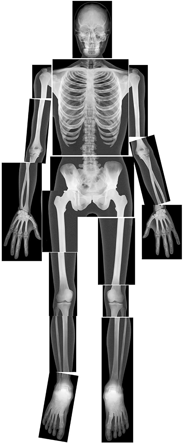 real human x-rays for kids