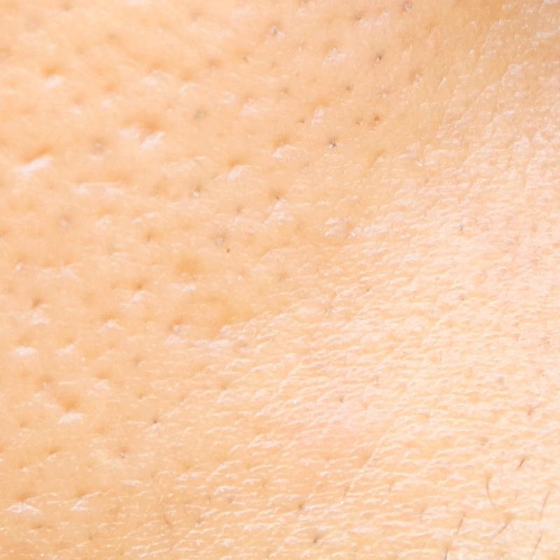 skin pores and hair