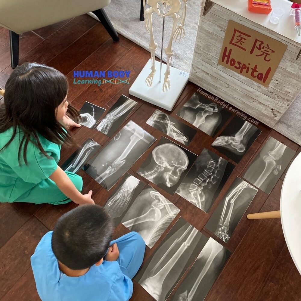 Skeleton and X-rays